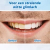 Tandenpolijster - 2